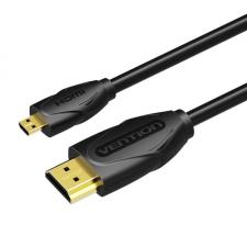 Cabluri video, Cablu video Vention VAA-D03-B150, Micro HDMI tata - HDMI tata, 4K, 30Hz, 3D, 1.5m, Negru, lerato.ro